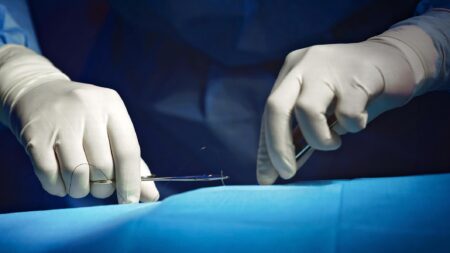15 Million Americans Live in a County Without a Surgeon