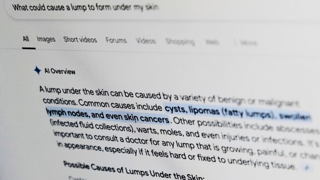 What’s that rash? Put some thought into asking Google for medical help