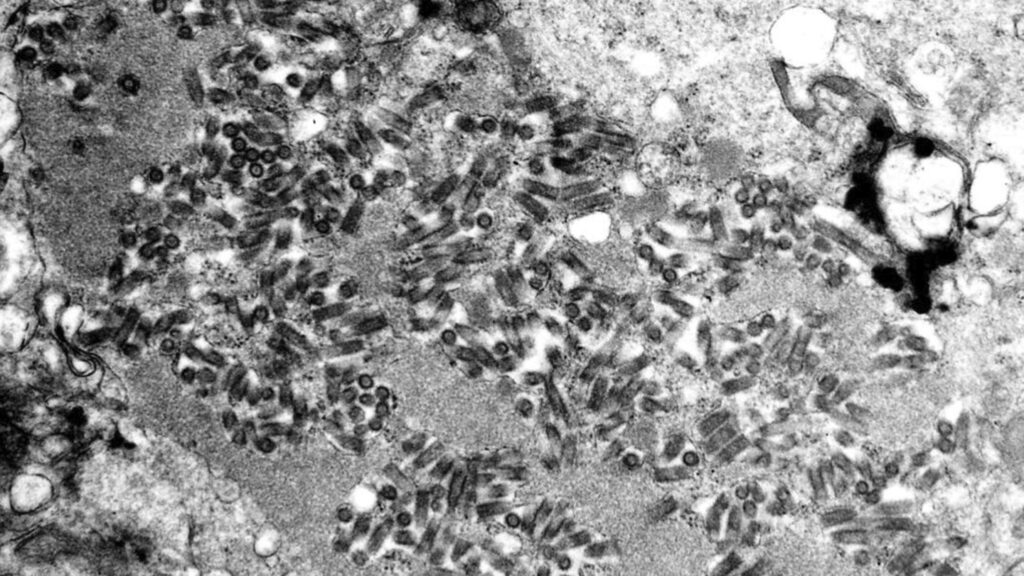 Organ transplant patient in Michigan dies from rabies
