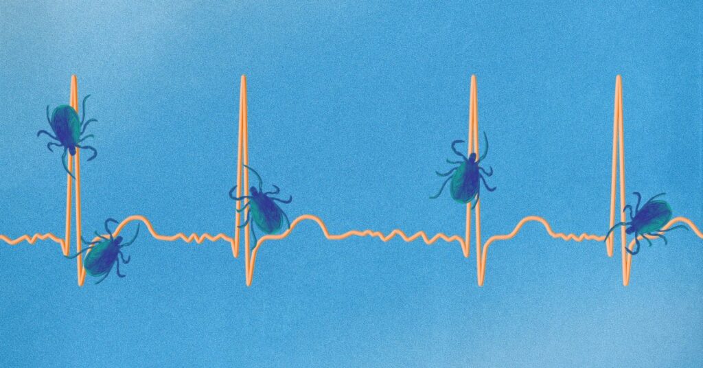 7 Surprising Symptoms of Lyme Disease