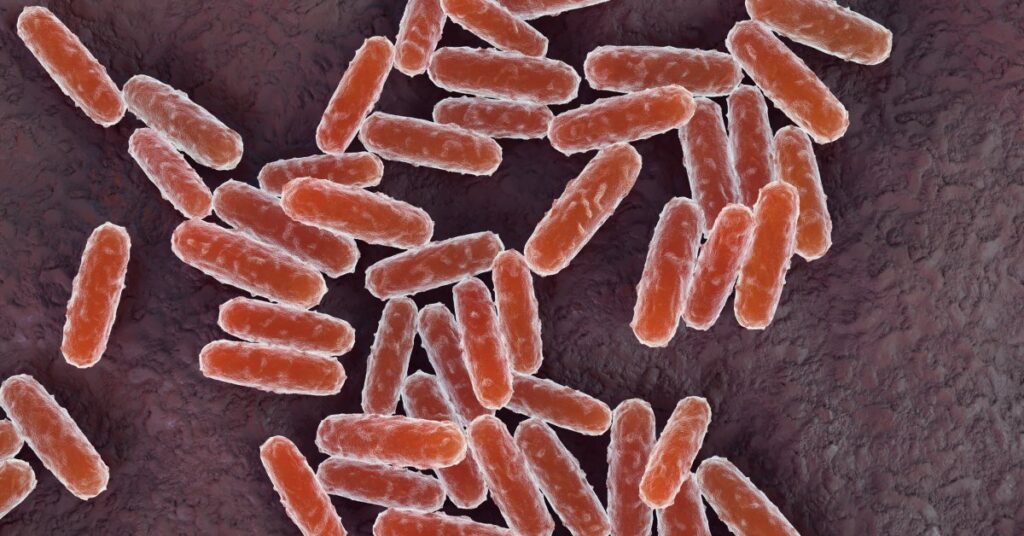 A California Resident Tests Positive for Plague. Here’s What to Know About the Disease