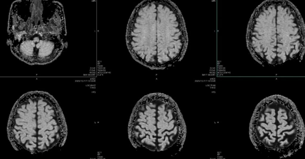 Healthcare Is AI’s Hardest Test
