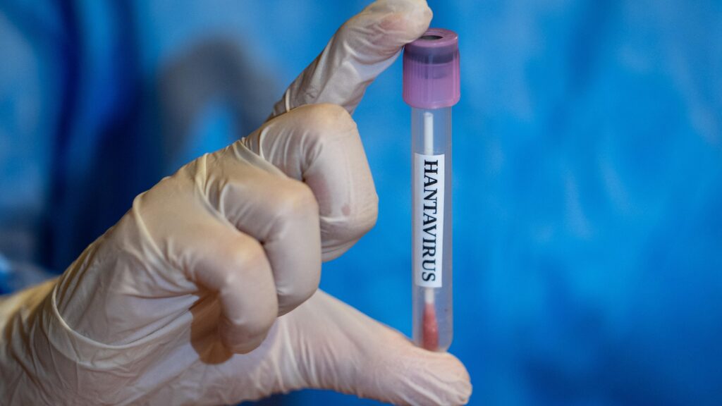 Several U.S. States Monitoring Cruise Passengers as Latest Hantavirus Case Reported