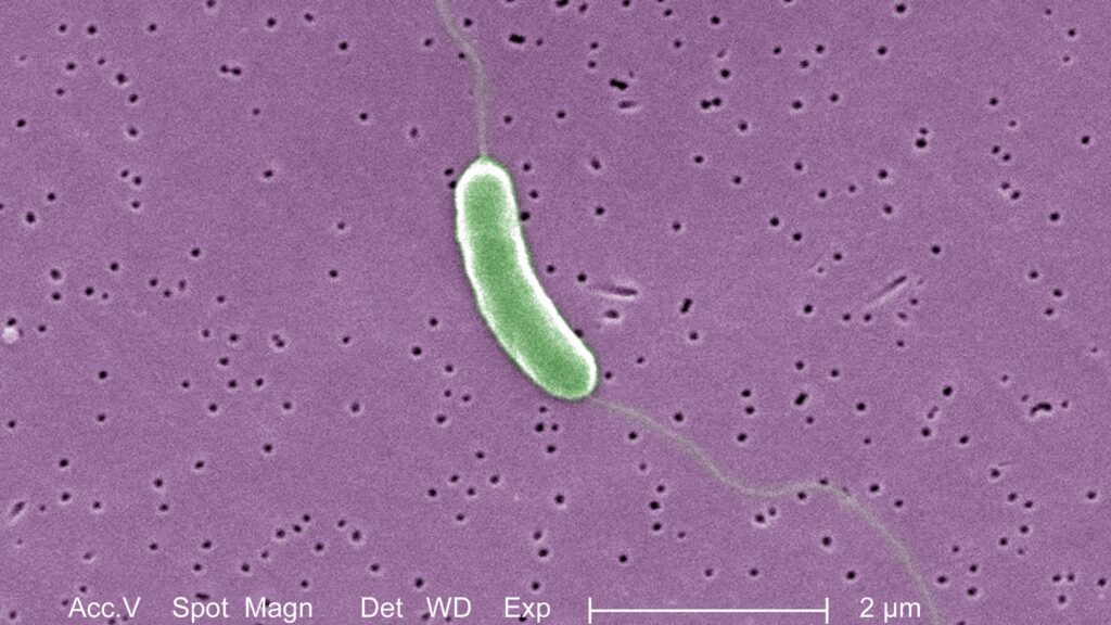 What to Know About Flesh-Eating Bacteria Vibrio Vulnificus