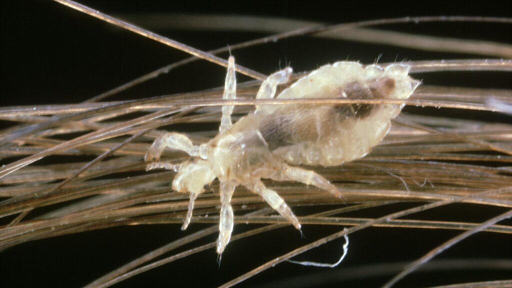 It’s Head Lice Season. Here’s What to Know